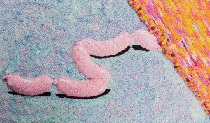 sorry, minified image is missing, click to see the bigger version